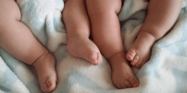 حیدر آباد،4ٹانگوں اور 4ہاتھوں والے بچے کی پیدائش